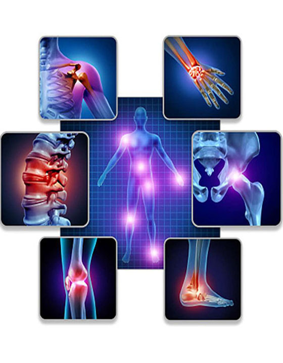 STEM CELL THERAPY FOR JOINT CALCIFICATION