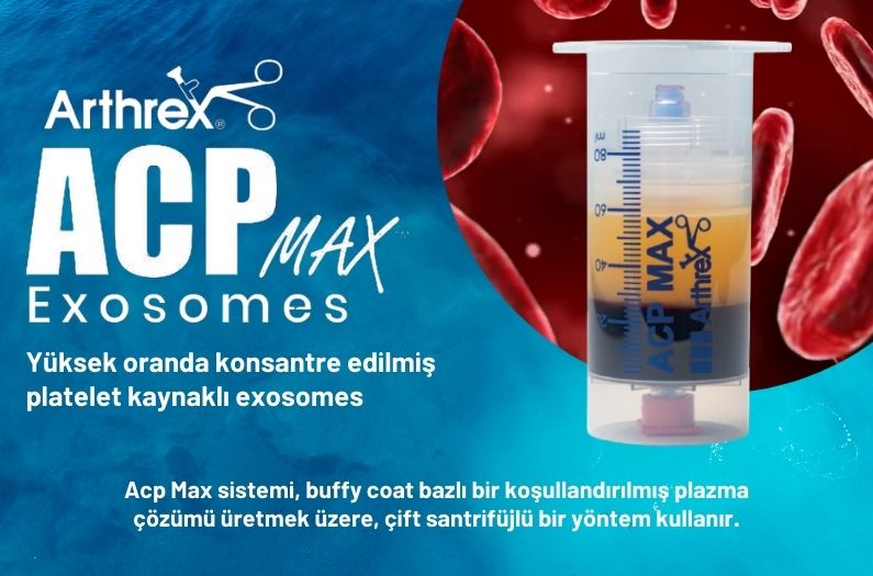 Arthrex ACP Max®