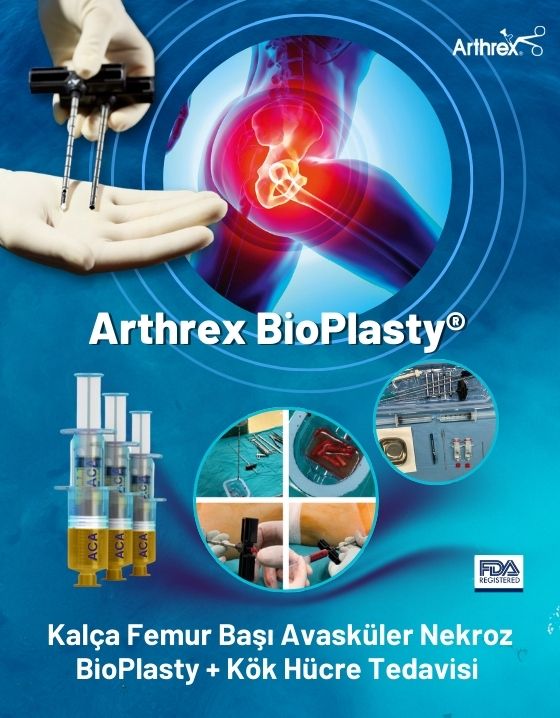 IOBP INTRAOSSEUS BİOPLASTY® TEKNOLOJİSİ