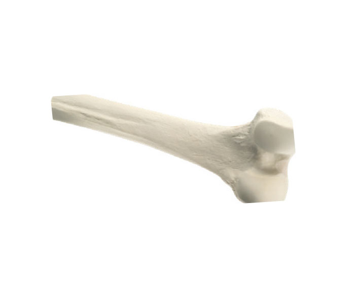  Structural Total Bones