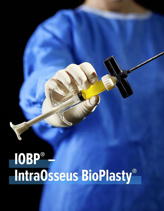 IOBP INTRAOSSEUS BİOPLASTY® TEKNOLOJİSİ