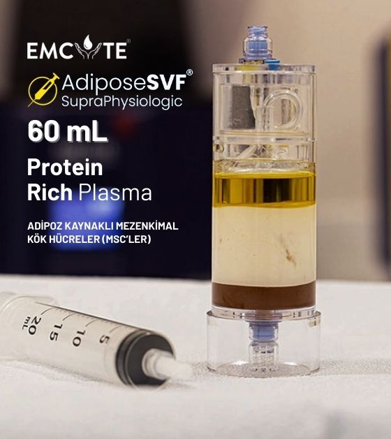 Emcyte AdiposeSVF® SupraPhysiologic